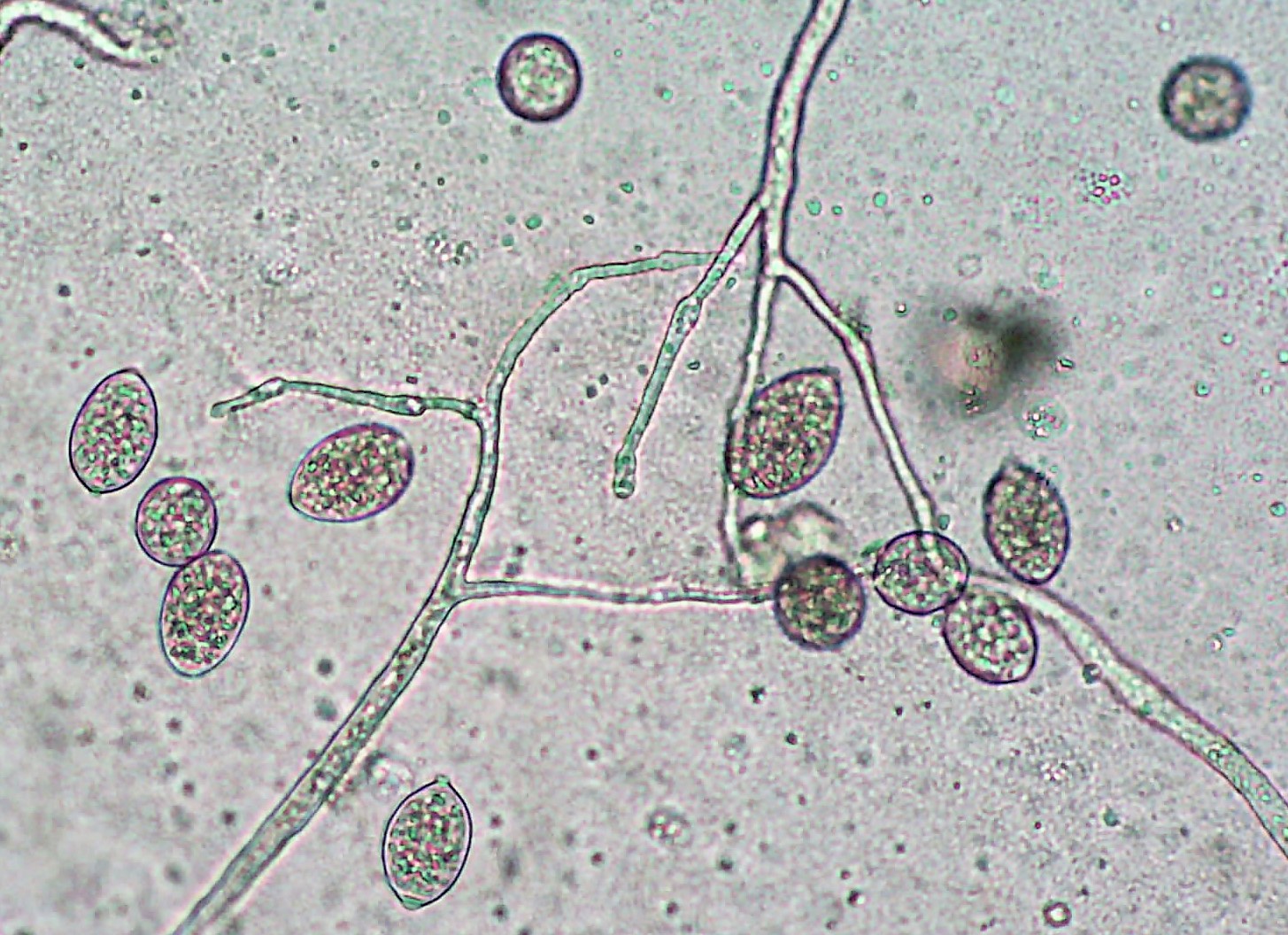 Phytophthora infestans sporangia and sporangiophores